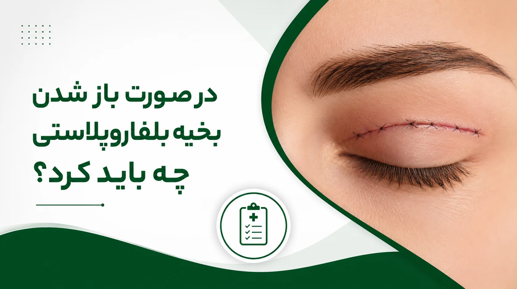 در صورت باز شدن بخیه بلفاروپلاستی چه باید کرد؟